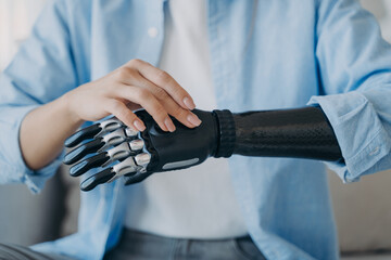 Cyber hand of female amputee. Disabled woman is changing settings of robotic prosthesis.