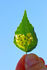 The edge of a birch leaf with a leafminer pocket