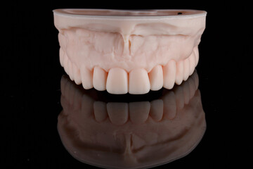 printed dental model of the upper jaw on a 3D printer, on black glass with reflection