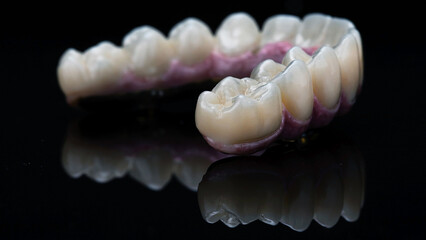 Fototapeta na wymiar macro dental photo of the prosthesis and morphology on black glass with reflection