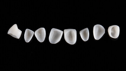 set of ceramic dental veneers for the upper jaw on a black background, top view © Dental Pro Content