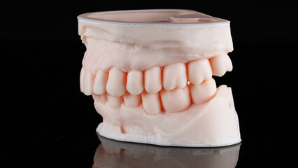 side view of a 3D printed dental model of the upper and lower jaws in bite on a black background