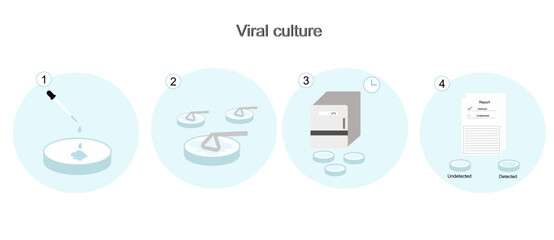 The methodology of Microbiological culture with spread plate technique to detect the Microorganism (virus, bacteria, fungus, etc.) for diagnosis or research - obrazy, fototapety, plakaty