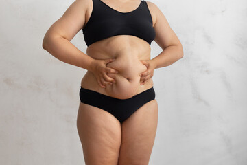 Unrecognizable overweight obese woman in black bikini touching and squeezing big dangling tummy. Hand self massage to dry friable cellulite skin. Body care. Food addiction, obsession, overeat problem - obrazy, fototapety, plakaty