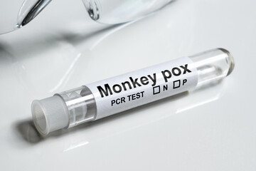 Monkeypox PCR test tube close-up. Equipment for monkey pox virus diagnostics