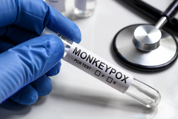 Monkeypox PCR test tube in doctors hand, medical kit for monkey pox virus diagnostics