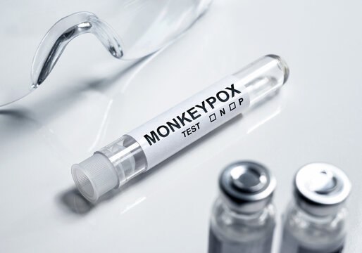 Monkey pox test tube on medical desk, monkeypox virus diagnosis concept