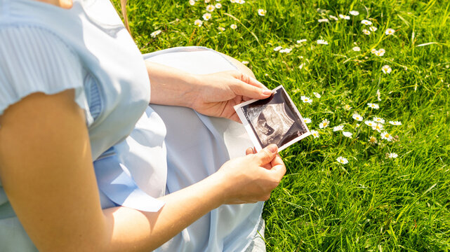 Ultrasound image pregnant baby photo. Woman holding ultrasound pregnancy picture on grass flower background. Pregnancy, medicine, pharmaceutics, health care and people concept.
