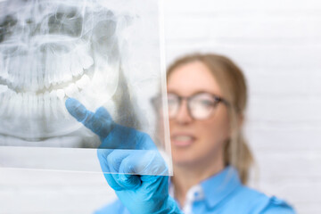 Close-up of a blonde woman doctor looks at a panoramic x-ray image of a patients jaw in the dental clinic and points a finger at a sore tooth. Dentistry, surgery, medicine technology concept.