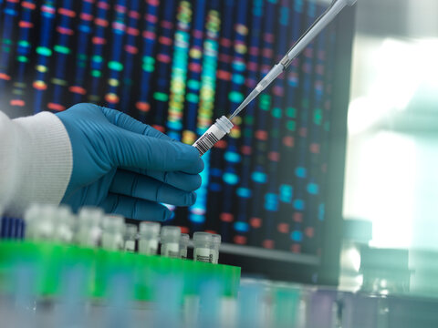 Scientist with pipette evaluating samples in laboratory