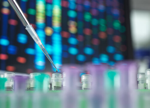 Pipette adding sample to test tube in laboratory