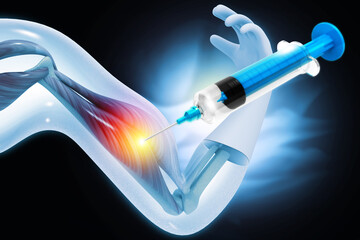 Arm muscle injury, pain, injection, 3d illustration