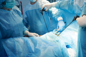 Surgical operation of the patient performed by several doctors - obrazy, fototapety, plakaty