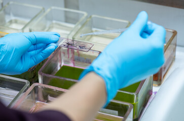 Medical scientists are preparing cytology specimens to detect abnormalities from a woman's cervix.