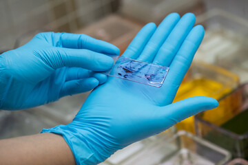 Medical scientists are preparing cytology specimens to detect abnormalities from a woman's cervix.