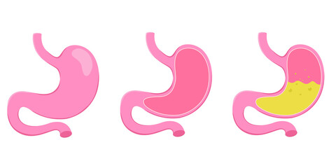 Healthy and unhealthy, empty and full human stomach. Digestive system anatomy. Vector illustration isolated on white background. © DisignUA