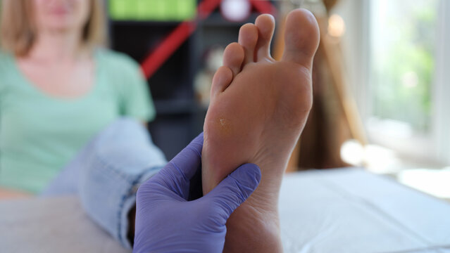 Doctor podiatrist in sterile gloves examining female foot
