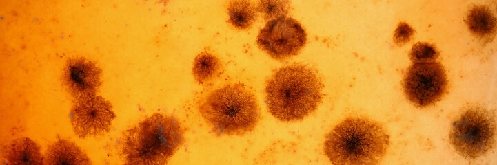 Microbes under microscope investigated material under professional laboratory equipment