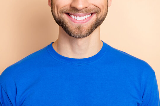 Cropped photo of young cheerful guy toothy smile visit dentist cavity protection clinic isolated over beige color background
