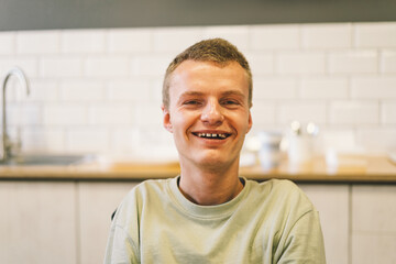 Portrait of young man handicapped with disabilities. Optimistic smiling disabled man. Invalid teen.