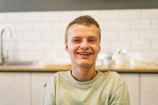 Portrait of young man handicapped with disabilities. Optimistic smiling disabled man. Invalid teen.