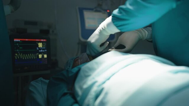 Surgeons and nurses help intensive care patient, making CPR and using defibrillator electrical devices to shock the heart to save a patient life. health care concept.