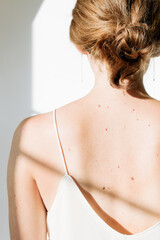 Back of young woman with moles, against background of wall and sunlight