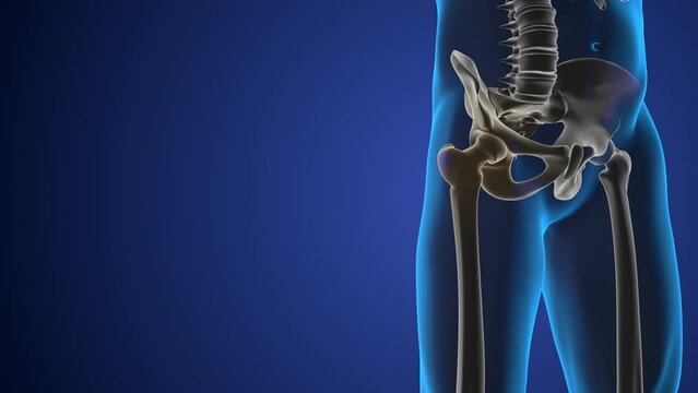 3d medical figure with hip bone pain
