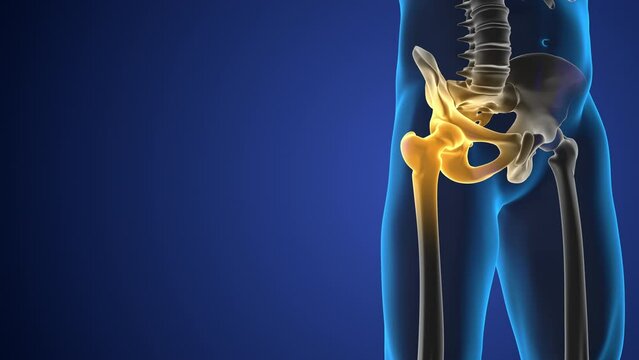 Pain in the hip joint medical background