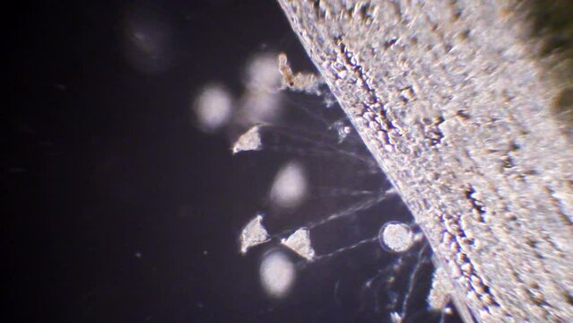 Vorticella, protozoa, phylum Ciliophora , microscopic freshwater organisms,