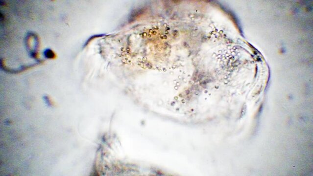 Vorticella, protozoa, phylum Ciliophora , microscopic freshwater organisms,