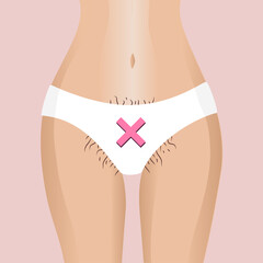 Young woman in lingerie with a neglected bikini area. Long hair from under the panties. Flat illustration for beauty salon, spa, skin care for the intimate zone of girls. Wax, sugar, laser depilation. - obrazy, fototapety, plakaty
