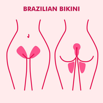 The scheme with areas for hair removal. Brazilian bikini. Female epilation and depilation with wax, sugar or laser. Flat style. Illustration for beauty salons.  Designation of the border hair removal.