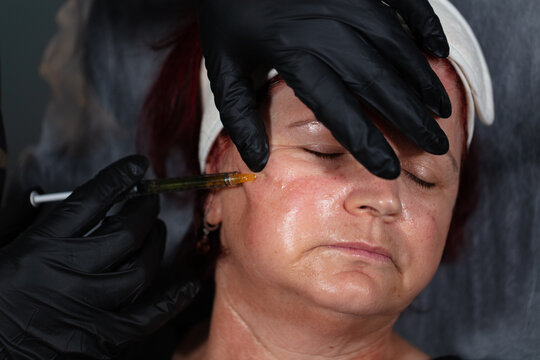 anti-aging aesthetic care. youth vaccine, skin care, skin rejuvenation procedures. Mature woman is getting treatment in aesthetic clinic. health and beauty concepts.
