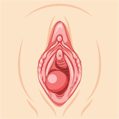 Bartholin's cyst gland Female reproductive system uterus. Front view. Human Surface anatomy of the perineum external organs location scheme, vagina pain vulva blockage flat style icon - obrazy, fototapety, plakaty