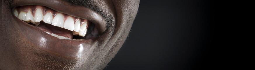 black man teeth close-up 