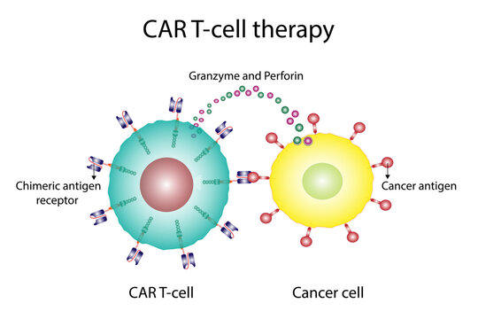 CAR T-cell therapy and Cancer treatment . Chimeric antigen receptor T cells. T cell receptor proteins that have been engineered to kill cancer ells. CAR T cells immunotherapy. Cancer therapy. Vector