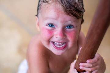 A blue-eyed child with sunburned red cheeks and blue eyes. A little cute girl on the beach smiles