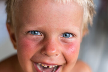 Portrait of a small blond boy tanned in the sun. A happy child with blue eyes smiles all over his...