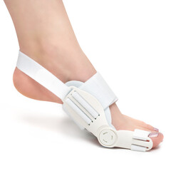 orthosis for bunions, hallux valgus on the woman's foot.