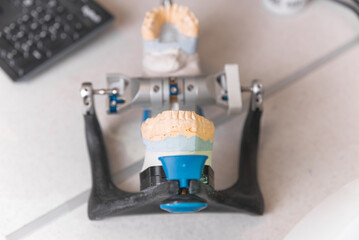 Photo of a gypsum denture held by an instrument lying on the table.