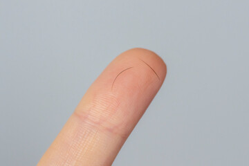 Eyelash loss concept. Two eyelashes on the phalanx of the finger. Close-up of fallen eyelashes....