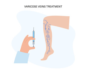 Varicose Injection procedure