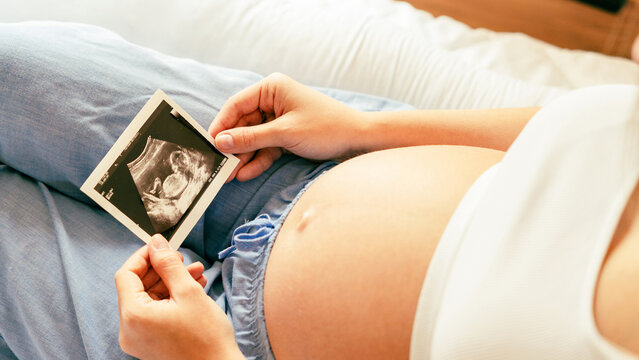 Ultrasound picture pregnant baby photo. Woman holding ultrasound pregnancy image. Concept of pregnancy, maternity, expectation for baby birth.