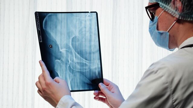 Doctor examining pelvis hip x-ray close-up. Magnetic Resonance Image of human leg. Man nurse looking at xray of foot bones. Healthcare and medicine concept.