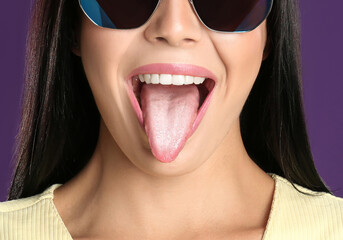 Young woman showing tongue with white patches on violet background, closeup. Oral candidiasis...