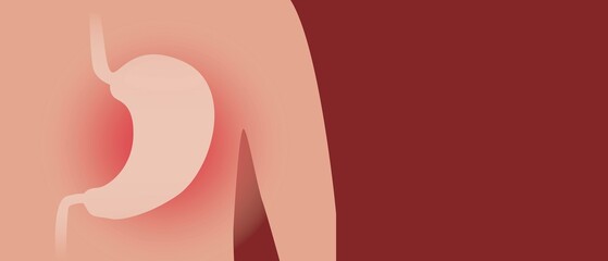 Stomach disease, copy space pattern, anatomical vector stock illustration with persona and gastritis disease