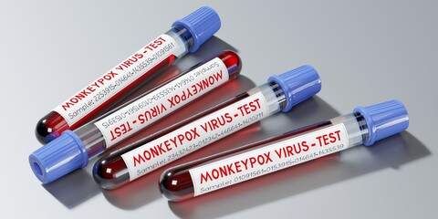 Monkey pox virus blood test vials - 3D illustration