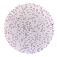 Red blood cell with Platelet in blood smear.