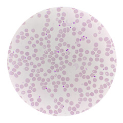 Red blood cell with Platelet in blood smear.